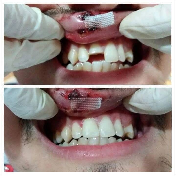 Before and after dental treatment
